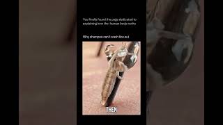 |Why shampoo can't kill lice?? #shorts #viralshorts #scientificfacts @AryansAcademy1