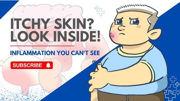 Understanding Allergies & Type 2 Inflammation - Why Itching, Sinus, and Asthma Are All Connected