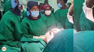 Upasuaji Wa Watoto Mapacha Walioungana Wafanikiwa Muhimbili, Tanzania Imekuwa Nchi Ya 3 Kufanyika