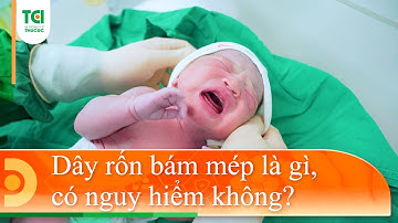 Dây rốn bám mép có nguy hiểm không?