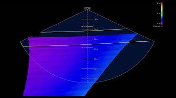 Tracker Optimizes Swath Width for Maximum Efficiency