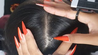 ASMR Scalp Check & Itchy Flake Removal 🔍 | Long Nails on Soft Hair #113 screenshot 1