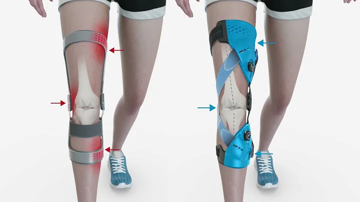 Unloader One X (Animation)