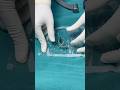 GUESS THE IMPLANT NAME Drpankajwalecha Orthopedicsurgeon 