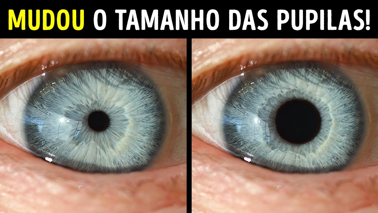 Ele Pode Controlar o Tamanho das Pupilas + 10 Pessoas com Habilidades Incomuns