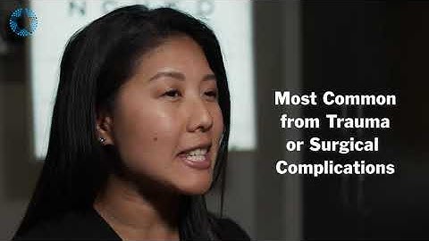 Ask the Expert: Dislocated Intraocular Lens