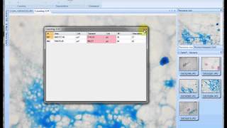Seiwa Insight - Detection Bacteria