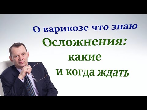 Осложнения варикоза, какие и когда. Видеобеседа для ВСЕХ.