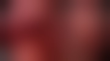 Laparoscopic Dissection Of Right Hypogastric Nerve & Inferior Hypogastric Plexus(NerveSparing)by A.T