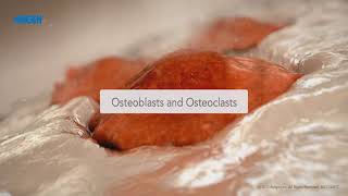 How Bone Is Repaired