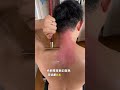 Tips for combing the meridians of the cervical vertebrae shoulders and neck#Good product