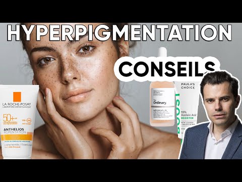 Vidéo: Comment traiter l'hyperpigmentation : 10 étapes (avec photos)