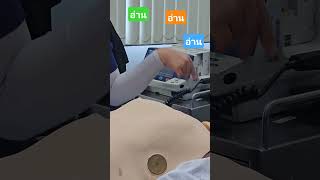 อ่าน อ่าน #nurse #acls #provider #2025