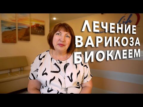 ЛЕЧЕНИЕ ВАРИКОЗА БИОКЛЕЕМ в АнгиоЛайф - отзыв пациента