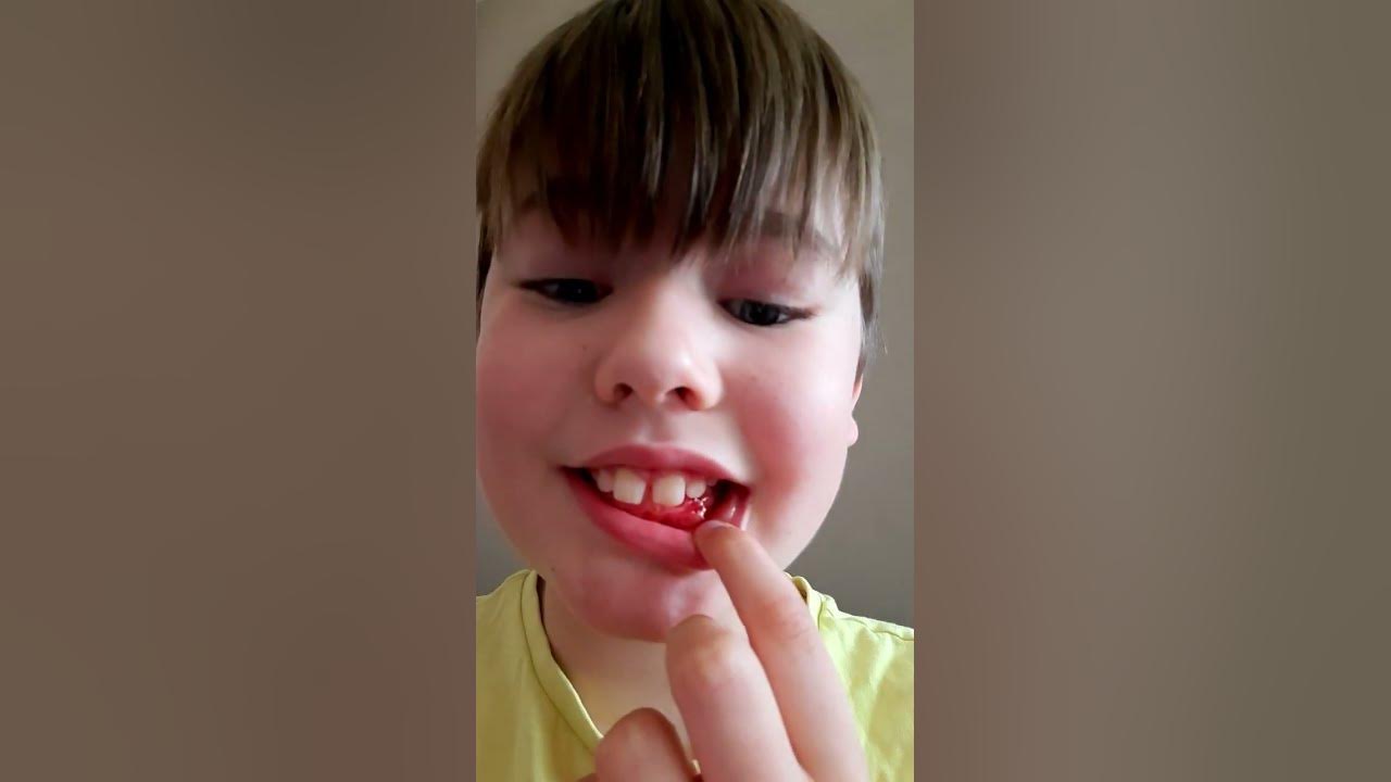 my tooth fell out - YouTube