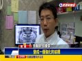 拔掉的牙齒再利用 磨成骨粉填補齒槽 民視新聞 拔掉的牙齒再利用 磨成骨粉填補齒槽 民視新聞