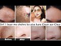 ऐसे करे चेहरे का Clean Up-सिर्फ 2 use में Whiteheads-Bumps-Blackhead-acne होंगे साफ़-मिलेगीclear skin