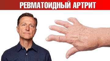 13 натуральных средств от ревматоидного артрита👌