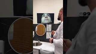 Коррекция носа в Махачкале / Пластика носа Али Раджабович / Операция на нос