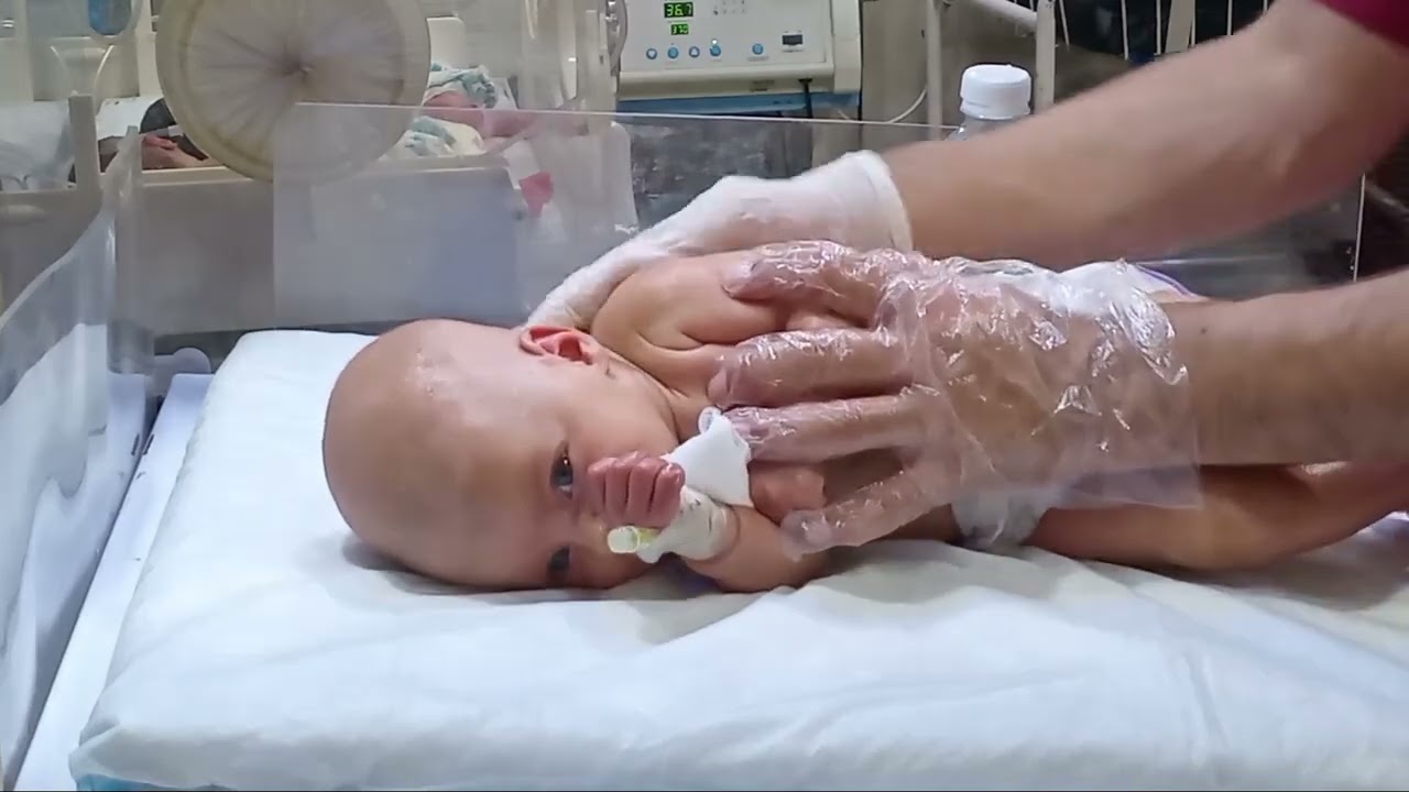 Physiotherapy in nicu