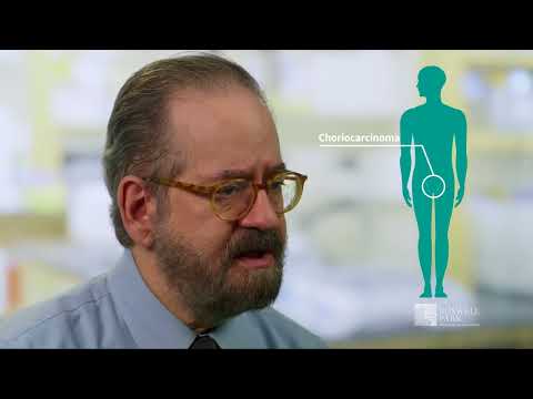 What is the Survival Rate of Testicular Cancer?
