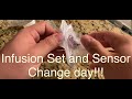 Minimed 770g Infusion Set and Sensor Change