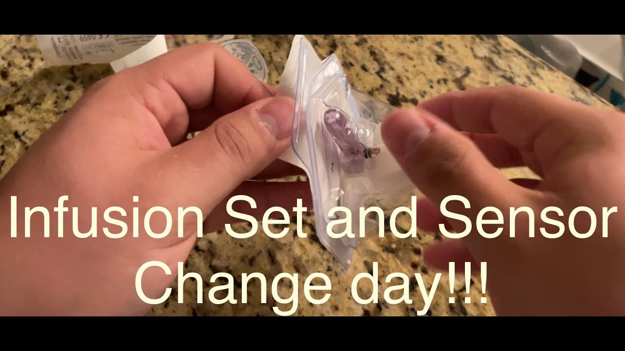 Medtronic Minimed 770g Infusion Set (Mio) and Guardian 3 Sensor Change