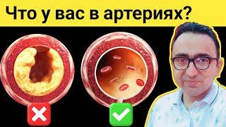картинка: Лучший тест №1 для выявления закупорки артерий в домашних условиях!