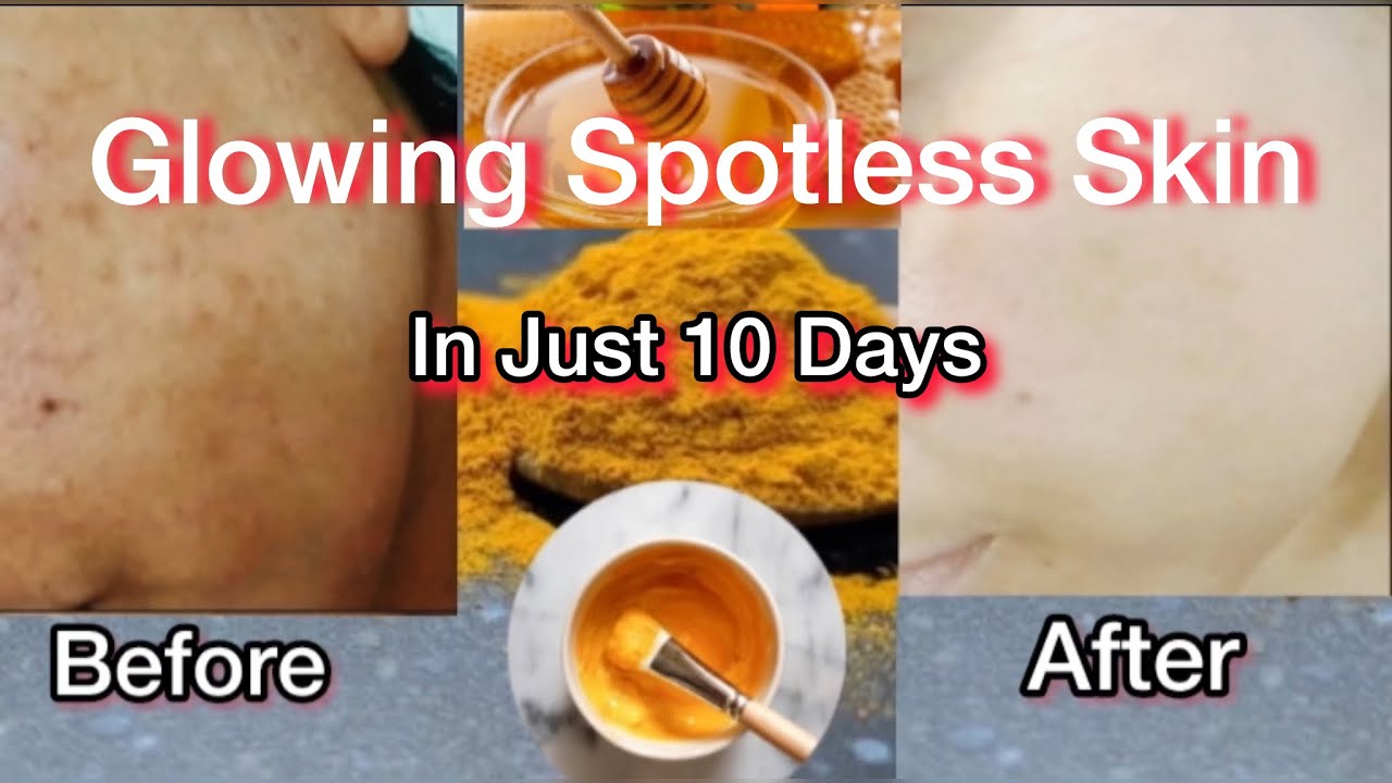 Fresh Look at How To Glow Up Naturally Clear Skin Secrets Revealed Pigmentation