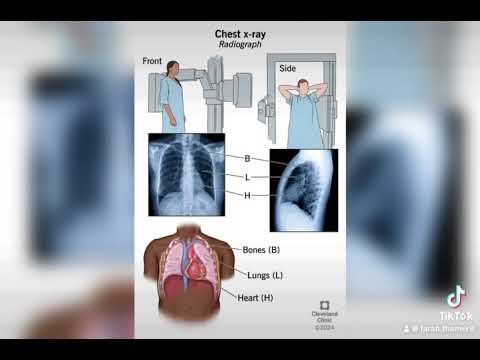 الفحوصات اللازمة التي يمكن ان يطلبها طبيبك قبل العملية