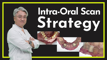 [DIGITAL DENTISTRY] Intra Oral Scan Stratery
