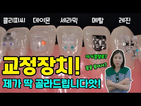   다양한 치아교정 장치 내 치아에 맞는 장치는 따로 있다고