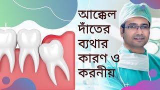 আক্কেল দাঁতের ব্যথার কারন ও করণীয়