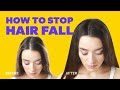 How To Stop Hair Fall & Hair Breakage | Causes Of Hair Fall, Treatment, Haircare Tips | Be Beautiful