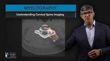What is Myelography​ of the Cervical Spine?