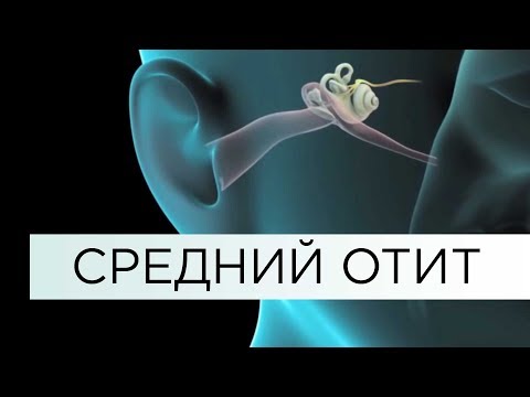 СРЕДНИЙ ОТИТ