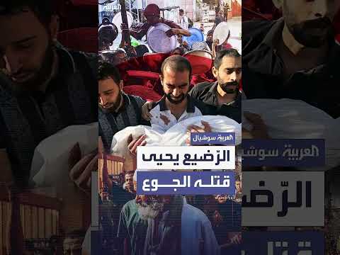 أزمة الجوع في غزة: وفيات أطفال وسوء تغذية حاد