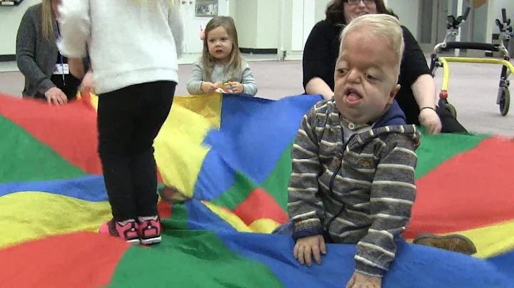 Alberta boy with rare syndrome like every other ki...