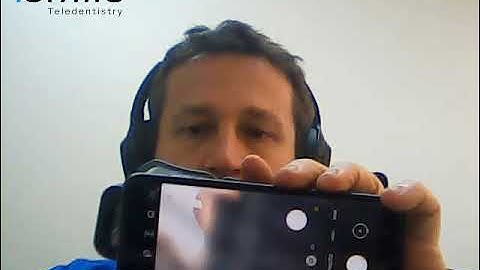 iSmile Teledentistry Remote Patient Monitoring : Fastening Phone to Remote Monitoring Scope