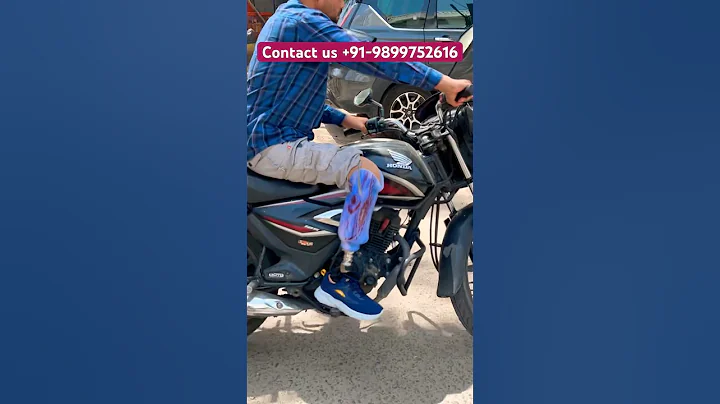 #artificiallimb #naturalwalk #belowkneeprosthesis #ossur #carbonfoot