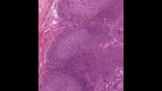 Shotgun Histology Small Intestine Ileum