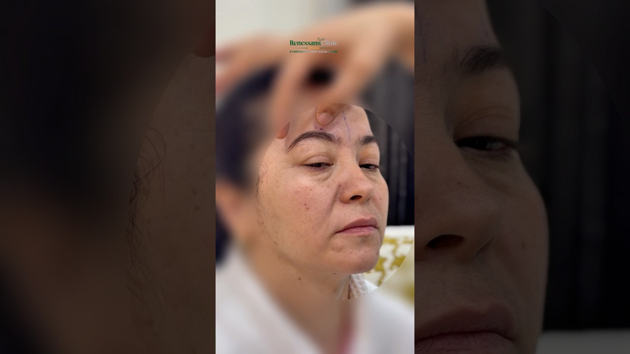 Professor Amrillo Inoyatov +998-90-027-77-76