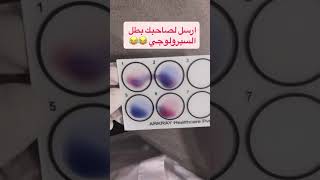#youtube #chemistry #laboratory #lab #youtubeshorts #shortvideo #shorts #viral #viralvideo #المختبر