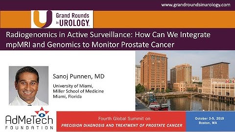 Radiogenomics in Active Surveillance How Can We Integrate mpMRI and Genomics to Monitor PCa