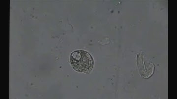 TiO2 Ag destroys E coli bacteria
