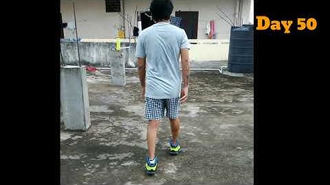 Tibia And Fibula Surgery Recovery After 50 Day