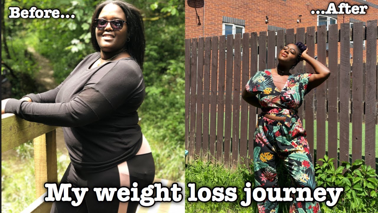 My weight loss journey (with PICS) PCOS, eating disorder, anxiety