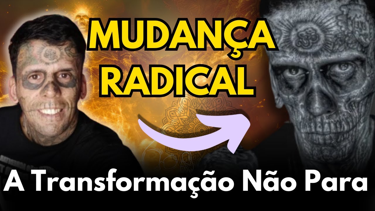 A Transformação do HOMEM MAIS TATUADO DO BRASIL.  2ª sessão de Remoção das Tatuagens. 💉📖🙌