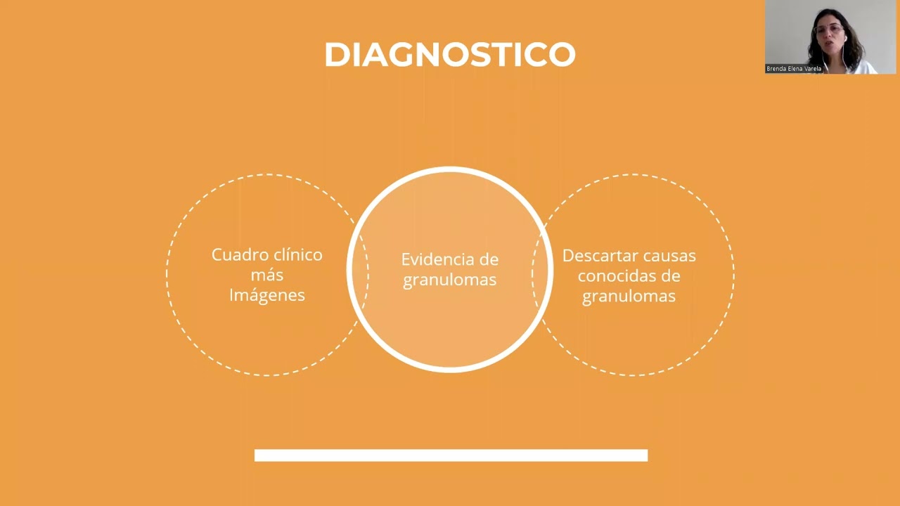 Sarcoidosis. Dra Brenda Varela