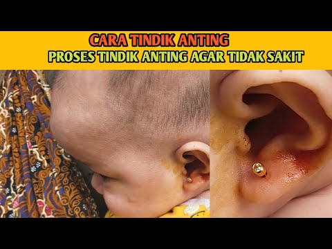 Cara Tindik Anting Bayi - Adek Aulia Fadhilah Az Zahra Proses Tindik Anting